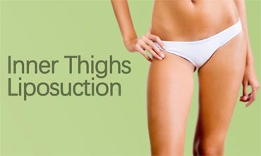 Inner Thighs Liposuction