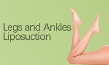Legs and Ankles Liposuction