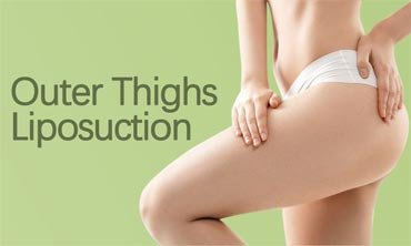 Outer Thighs Liposuction